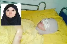 اسید-پاشی-در-حقوق-کیفری-ایران
