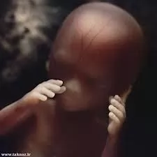 سقط-جنین-حرمت-یا-جواز